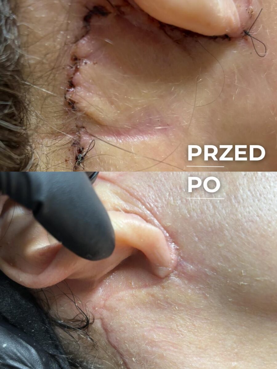 Holiestetyka — wsparcie onkologiczne, efekt terapii