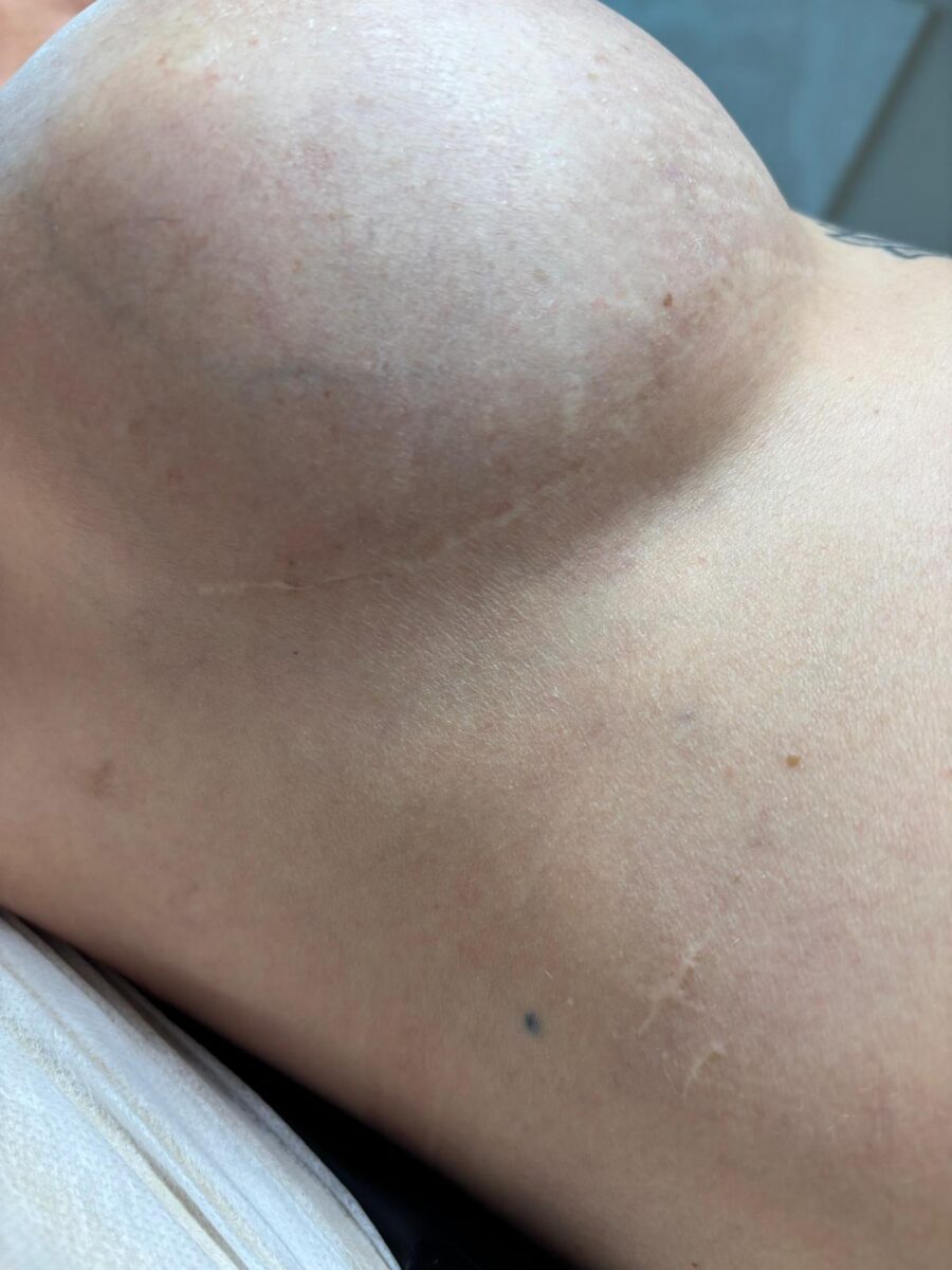 Holiestetyka — wsparcie onkologiczne, efekt terapii