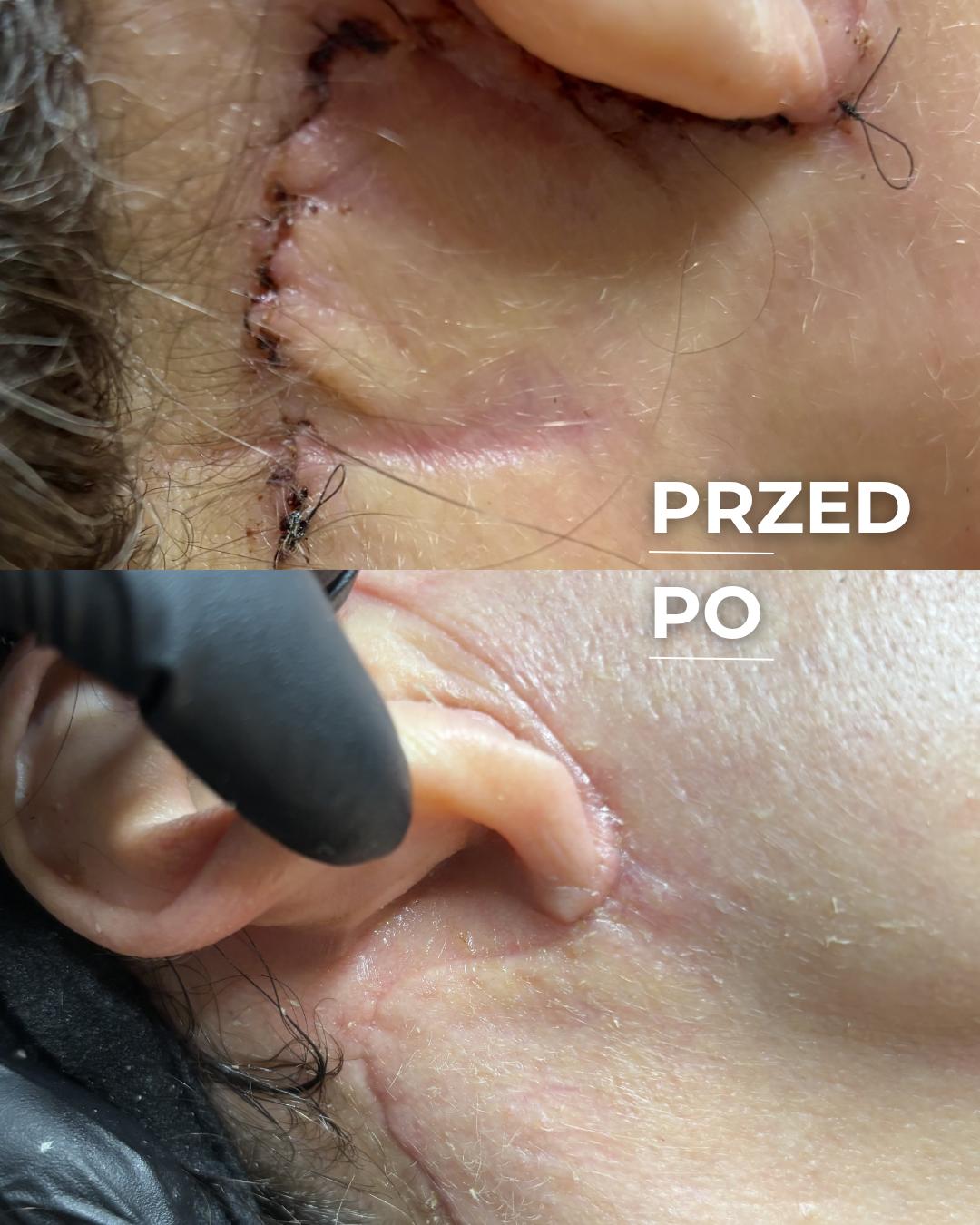 Holiestetyka — wsparcie onkologiczne, efekt terapii